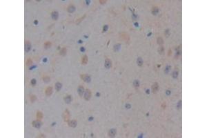 Used in DAB staining on fromalin fixed paraffin-embedded kidney tissue (CELSR3 antibody  (AA 942-1175))
