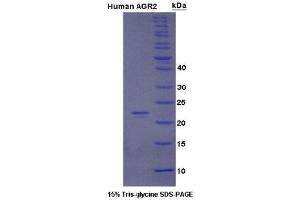 SDS-PAGE (SDS) image for Anterior Gradient Homolog 2 (Xenopus Laevis) (AGR2) (AA 21-175) protein (His tag) (ABIN1078843)