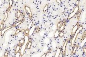 Immunohistochemistry analysis of paraffin-embedded mouse kidney using Endostatin (ABIN7073823) at dilution of 1:1200 (COL18A1 antibody)