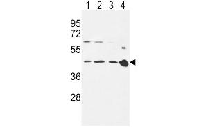 Western Blotting (WB) image for anti-Chemokine (C-C Motif) Receptor 7 (CCR7) antibody (ABIN3002197)