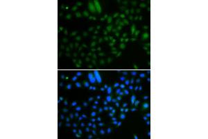 Immunofluorescence analysis of A549 cells using ALKBH8 antibody. (ALKBH8 antibody  (AA 1-230))