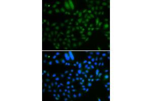 Immunofluorescence analysis of A549 cells using ALKBH8 antibody. (ALKBH8 antibody  (AA 1-230))