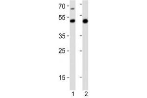 Western blot analysis of lysate from 1) mouse heart and 2) rat stomach tissue lysate using Gata6 antibody at 1:1000.