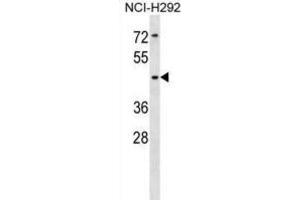 Western Blotting (WB) image for anti-Sialic Acid Binding Ig-Like Lectin 14 (SIGLEC14) antibody (ABIN5018304) (SIGLEC14 antibody)