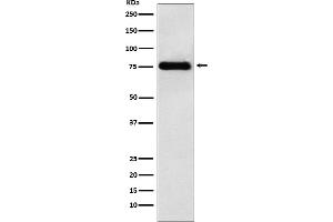 Western blot analysis of LYRIC expression in HeLa cell lysate.