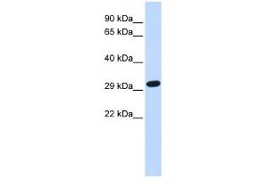 SDCBP antibody used at 1 ug/ml to detect target protein. (SDCBP antibody)