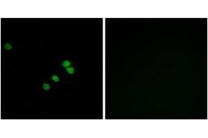 Immunofluorescence analysis of HepG2 cells, using SP1 (Ab-739) Antibody.