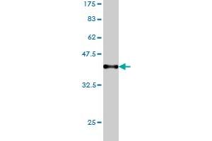 Western Blot detection against Immunogen (37. (KNTC1 antibody  (AA 2100-2209))