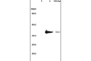 Lane 1: mouse heart lysates Lane 2: mouse brain lysates probed with Anti ADORA2B Polyclonal Antibody, unconjugated (ABIN759536) at 1:200 in 4 °C Followed by conjugation to secondary antibody (ABIN727474-HRP) at 1:3000 90min in 37 °C Predicted band 39kD. (Adenosine A2b Receptor antibody  (AA 101-200))