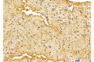 anti-CDC42 Binding Protein Kinase alpha (DMPK-Like) (CDC42BPA) (Internal Region) antibody