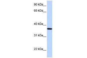 WB Suggested Anti-LCN12 Antibody Titration: 0. (LCN12 antibody  (N-Term))