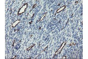 Image no. 1 for anti-Platelet/endothelial Cell Adhesion Molecule (PECAM1) antibody (ABIN1497251)