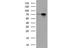 HEK293T cells were transfected with the pCMV6-ENTRY control (Left lane) or pCMV6-ENTRY SAMHD1 (Right lane) cDNA for 48 hrs and lysed. (SAMHD1 antibody)