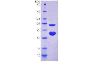 SDS-PAGE (SDS) image for Arginine Vasopressin Induced Protein 1 (AVPI1) (AA 13-148) protein (His tag) (ABIN4990005) (AVPI1 Protein (AA 13-148) (His tag))