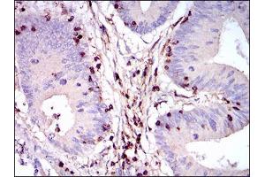 Immunohistochemistry (IHC) image for anti-Protein tyrosine Phosphatase, Receptor Type, C (PTPRC) (AA 928-989) antibody (ABIN5542495)