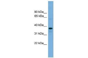 VPS16 antibody used at 0. (VPS16 antibody  (N-Term))