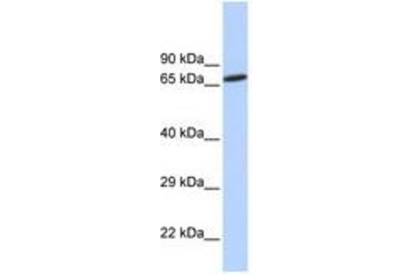 ZNF571 anticorps  (AA 144-193)