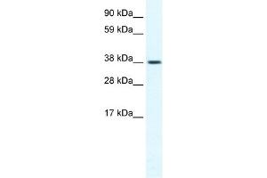 TRPM3 antibody used at 1. (TRPM3 antibody  (N-Term))
