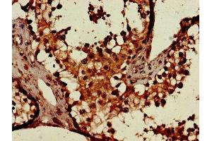 Immunohistochemistry of paraffin-embedded human testis tissue using ABIN7154406 at dilution of 1:100 (CSF2RA antibody  (AA 23-320))