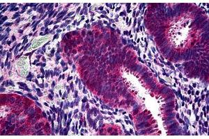 Human Uterus: Formalin-Fixed, Paraffin-Embedded (FFPE) (PHPT1 antibody  (N-Term))