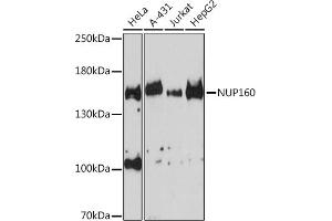 Western blot analysis of extracts of various cell lines, using NUP160 Rabbit pAb (ABIN6133841, ABIN6144957 and ABIN7101841) at 1:3000 dilution. (NUP160 antibody)