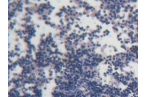 DAB staining on IHC-P; Samples: Rat Lymph node Tissue (ACP6 antibody  (AA 33-413))