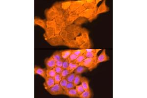 Immunofluorescence analysis of  cells using LORICRIN Rabbit pAb (ABIN7268295) at dilution of 1:200 (40x lens). (LOR antibody)