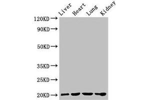 Western Blot Positive WB detected in: Rat liver tissue, Mouse heart tissue, Mouse lung tissue, Mouse kidney tissue All lanes: GPIHBP1 antibody at 4 μg/mL Secondary Goat polyclonal to rabbit IgG at 1/50000 dilution Predicted band size: 20 kDa Observed band size: 20 kDa (GPIHBP1 antibody  (AA 21-151))