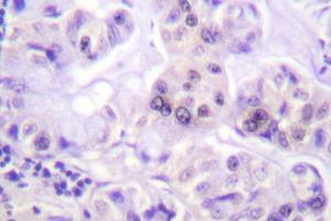 Image no. 1 for anti-Parkinson Protein 2, E3 Ubiquitin Protein Ligase (Parkin) (PARK2) antibody (ABIN271936) (Parkin antibody)