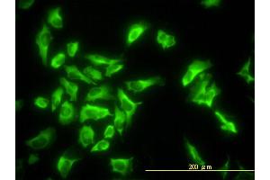 Immunofluorescence of monoclonal antibody to EEF1G on HeLa cell.