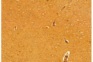 ABIN6263901 and ABIN6278065 at 1/100 staining Mouse brain tissue by IHC-P. (ORAI1 antibody  (C-Term))
