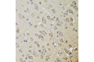 Immunohistochemistry of paraffin-embedded rat brain using CHN1 antibody (ABIN5974737) at dilution of 1/100 (40x lens). (CHN1 antibody)