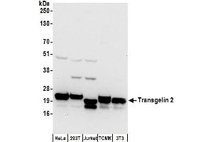 anti-Transgelin 2 (TAGLN2) (AA 111-161) antibody