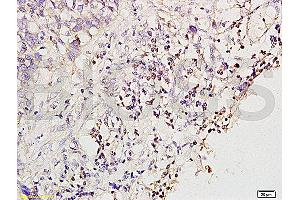 Formalin-fixed and paraffin embedded rat brain tissue labeled with Anti-MGMT Polyclonal Antibody (ABIN730768), Unconjugated at 1:200 followed by conjugation to the secondary antibody and DAB staining