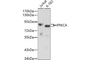 Western blot analysis of extracts of various cell lines using PRKCA Polyclonal Antibody. (PKC alpha antibody)