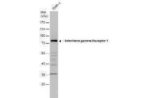 WB Image Interferon gamma Receptor 1 antibody detects Interferon gamma Receptor 1 protein by western blot analysis. (IFNGR1 antibody)