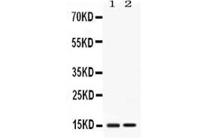 Western blot analysis of Apolipoprotein CIII expression in rat liver extract ( Lane 1) and mouse liver extract ( Lane 2).