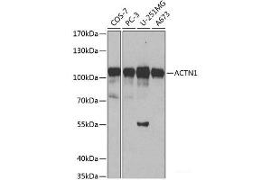 Western blot analysis of extracts of various cell lines using ACTN1 Polyclonal Antibody at dilution of 1:500. (ACTN1 antibody)