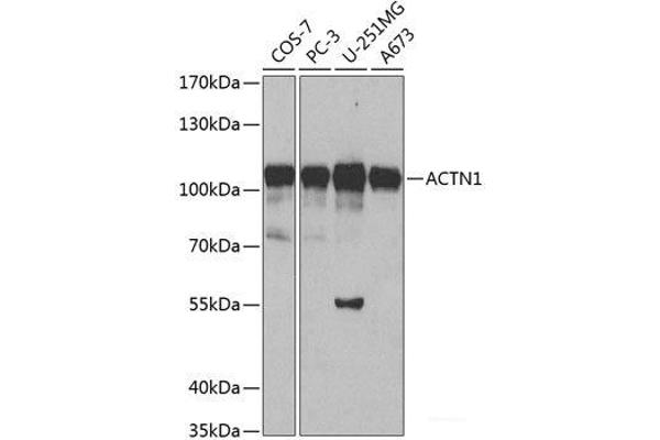 ACTN1 anticorps