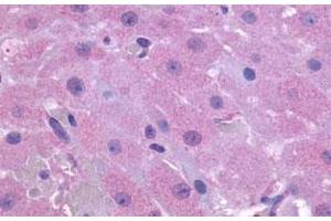 Immunohistochemical (Formalin/PFA-fixed paraffin-embedded sections) staining in human ovary with PTGFR polyclonal antibody . (PTGFR antibody  (2nd Extracellular Domain))
