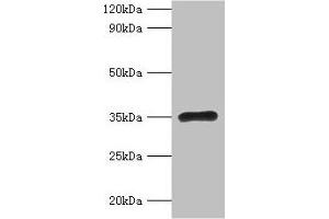 Western blot All lanes: RPL5 antibody at 2 μg/mL + EC109 whole cell lysate Secondary Goat polyclonal to rabbit IgG at 1/15000 dilution Predicted band size: 35 kDa Observed band size: 35 kDa (RPL5 antibody  (AA 2-297))
