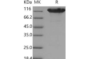 Western Blotting (WB) image for Angiotensin I Converting Enzyme 2 (ACE2) protein (His tag,Fc Tag) (ABIN7320349)
