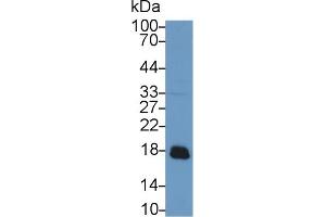 Western blot analysis of Rat Liver lysate, using Rabbit Anti-Rat ACP1 Antibody (1 µg/ml) and HRP-conjugated Goat Anti-Rabbit antibody (abx400043, 0.
