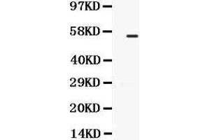 Western Blotting (WB) image for anti-Transforming Growth Factor, beta Receptor 1 (TGFBR1) (AA 149-186), (N-Term) antibody (ABIN3043310)