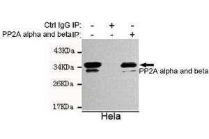 Immunoprecipitation analysis of Hela cell lysates using A alpha and beta mouse mAb. (PP2A alpha/beta antibody)
