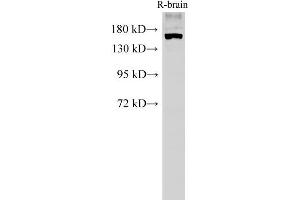 Western Blot analysis of Rat brain tissue using PARD3A Polyclonal Antibody at dilution of 1:500 (PARD3 antibody)