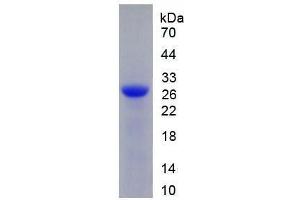 Deoxyribonuclease I (DNASE1) (AA 19-259) (Active) protein (His tag)
