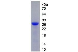 Image no. 1 for Deoxyribonuclease I (DNASE1) (AA 19-259) (Active) protein (His tag) (ABIN6239898)