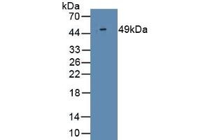 Detection of Recombinant IFNa2, Human using Monoclonal Antibody to Interferon Alpha 2 (IFNa2) (IFNA2 antibody  (AA 24-188))
