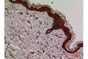 Immunohistochemistry (IHC) analysis of paraffin-embedded Human Skin, antibody was diluted at 1:100. (KEAP1 antibody  (Internal Region))